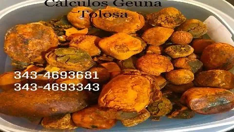 La imagen 3 de la Empresa CALCULOS BILIARES  BOVINOS